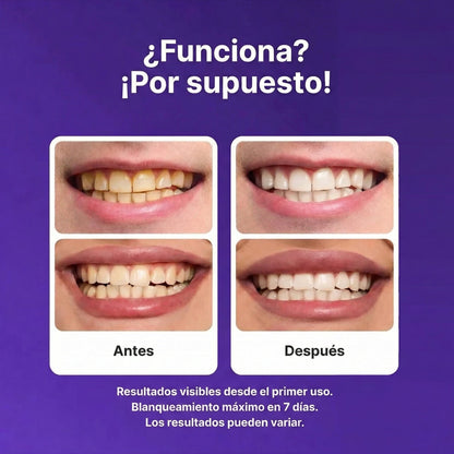 DesinSmile - Tiras blanqueadoras para dientes